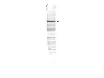 Anti-CDC27 antibody used in Western Blot (WB). GTX41386
